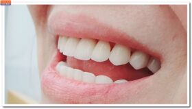 Các dịch vụ tại nha khoa Thăng Long